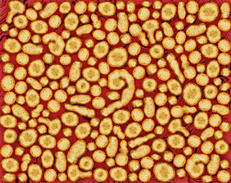 Influenzavirus. 