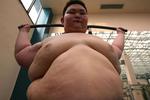 CHINA OBESITY