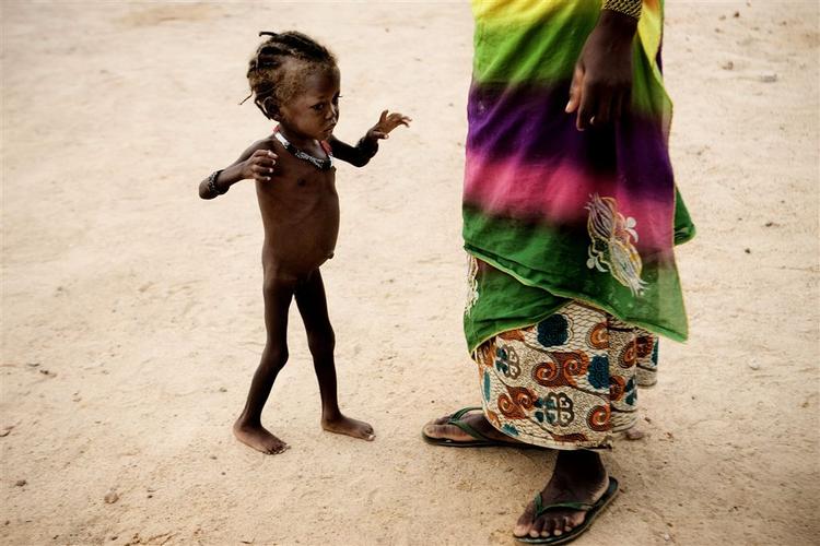 Unicef efterlyser 4,5 milliarder kroner til verdens fattigste børn i Afrika. 