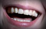 Det store smil er fremme - danskernes tænder har aldrig været bedre. 