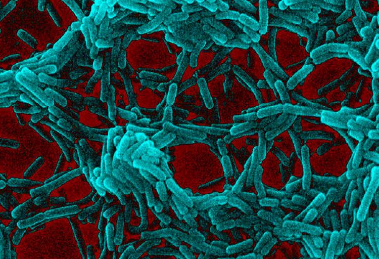 Clostridium difficile 027 has arrived in Denmark. Picture,however, shows a benevolent bacteria Lactobacillus. 