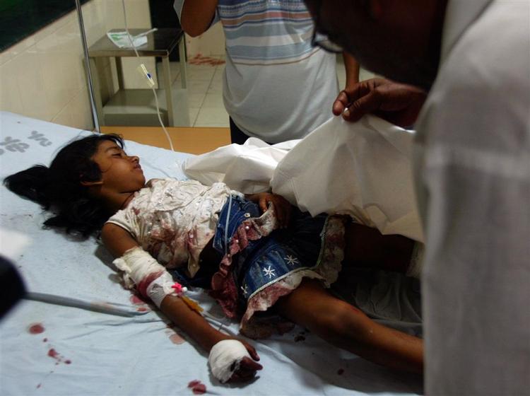 Den fire år gamle Subanah undersgøes af en læge. Hun er en af de omkring 200 sårede efter bombeangreb i Jaipur i delstaten Rajastan i Indien. 