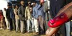 Vælgere i Zimbabwe bruger maling til at markere deres stemmeafgivning. Hvis de tør. Mange er truet væk fra valgstederne. I dag ventes de første resultater. 