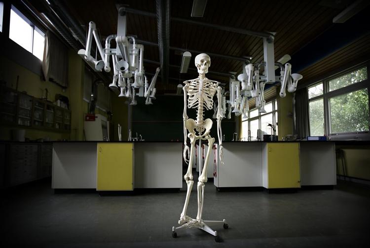 Skelettet bliver stærkere af høj vægt - men mandre andre dele af kroppen har bedst af en moderat vægt. 