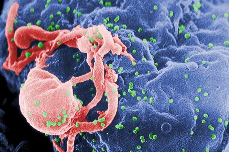 Der findes adskillige dræbende virusser i Afrika - her er det hiv i aktion - men det nye dræbervirus hører ikke til de kendte. 