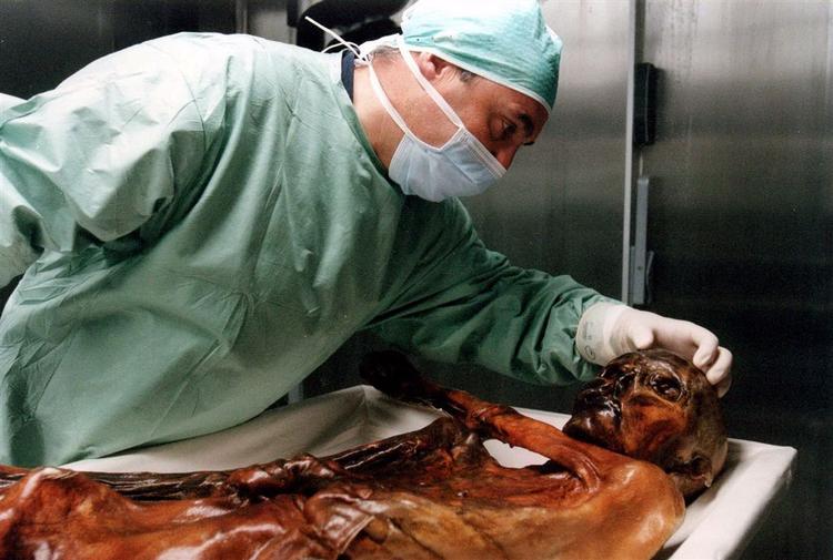 En forsker undersøger ismanden Otzi i Balzano i det nordlige Italien. Arkivfoto. 