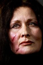 Det vurderes, at 28.000 danske kvinder årligt får bank af deres partner. Amnesty International satte fokus på problemet ved et modeshow i 2004, hvor modellerne var sminkede. 