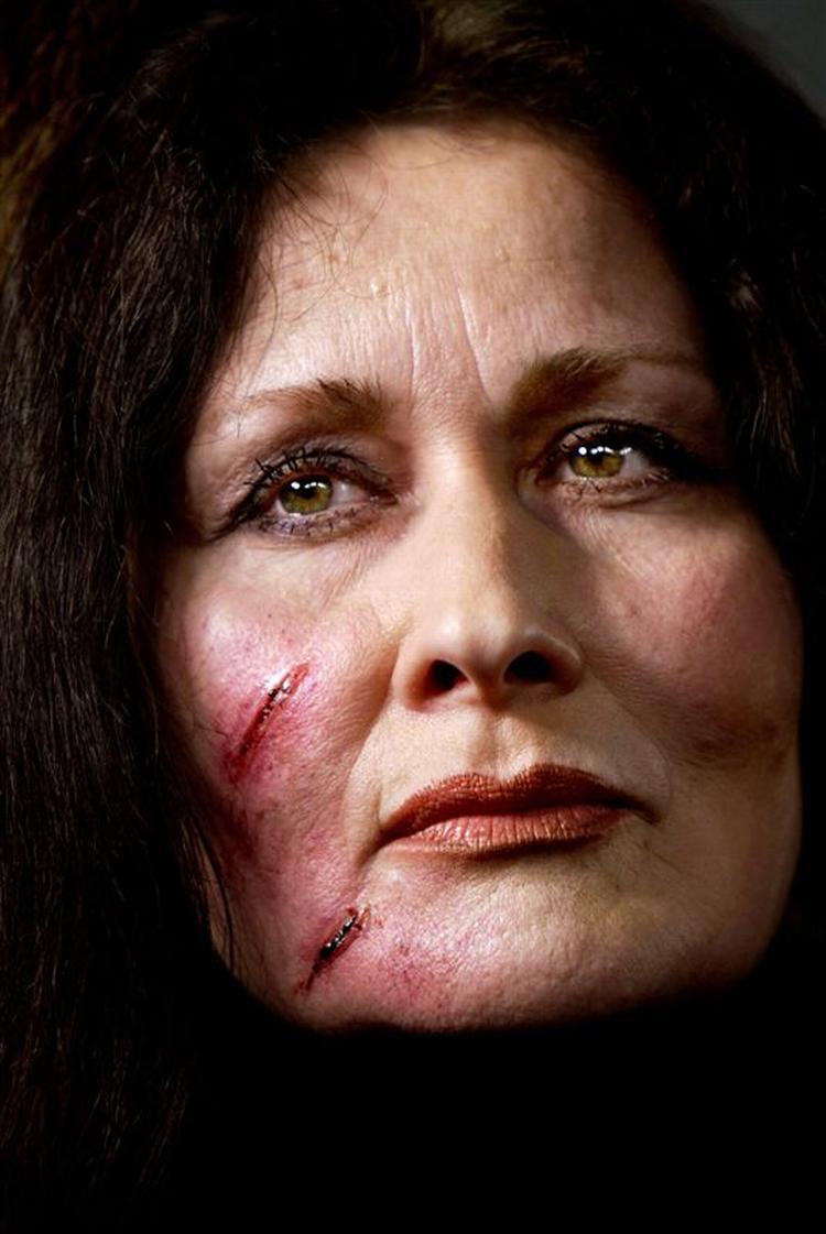 Det vurderes, at 28.000 danske kvinder årligt får bank af deres partner. Amnesty International satte fokus på problemet ved et modeshow i 2004, hvor modellerne var sminkede. 