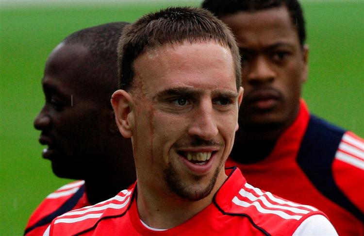 Fodboldstjernen Franck Ribery er stolt af sit ar, som han pådrog sig som dreng ved en trafikulykke. 