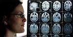 BRAIN CANCER