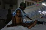 Femårige Duclair Mackenson er et af de underernærede børn, der befinder sig på Læger uden Grænsers hospital i Port-au-Prince. 