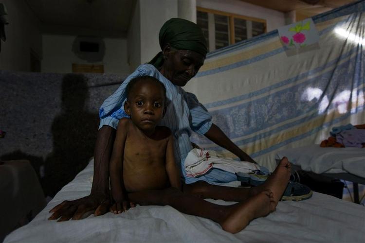 Femårige Duclair Mackenson er et af de underernærede børn, der befinder sig på Læger uden Grænsers hospital i Port-au-Prince. 