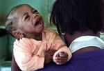 En lille pige, der er smittet med hiv, fra Sparrowa Nest, et hospice i Roodespoort, Sydafrika. 