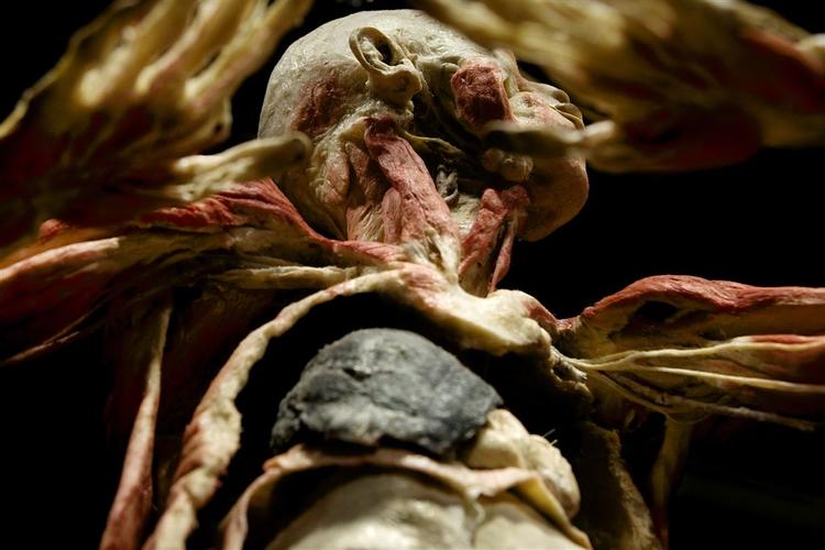 Dr. Glover åbner sin udstilling af silikonemumificerede lig på H.C. Andersen-slottet ved Tivoli. Udstillingen hedder Bodies. 