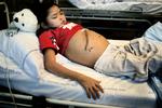 Transplantationer er livredddende. Her er det en grønlandsk pige, der har gennemgået en levertransplantation. 