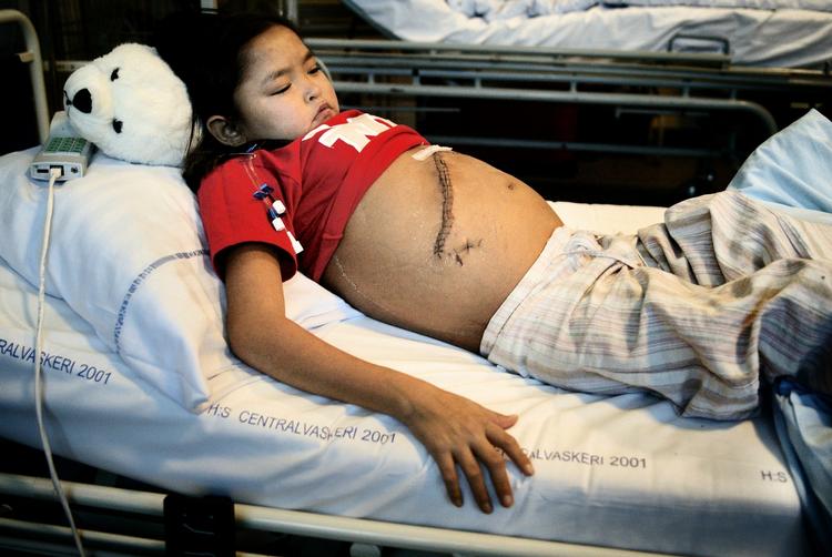 Transplantationer er livredddende. Her er det en grønlandsk pige, der har gennemgået en levertransplantation. 