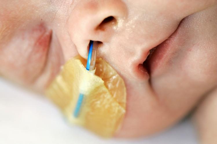 Børn som er blevet undfanget ved kunstig befrugtning fødes oftere som tvillinger og for tidligt. Det forøger risikoen for at de rammes af spastiske lammelser. 