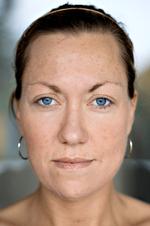 »Jeg kan mærke, at min hud er blevet en smule blødere, men arrene er præcis, som de var, før jeg begyndte at smøre mig med cremen«, siger Pernille Gormsen. 