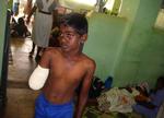 Denne dreng befandt sig på et hospital, som Røde Kors måtte rømme efter angreb udefra. Organisationer frygter for de civilbefolkningen i Sri Lanka. 