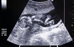 Pige eller dreng? Mellem fem og ti gravide kvinder i Danmark vælger en abort, fordi de venter en pige. (Arkivfoto) 