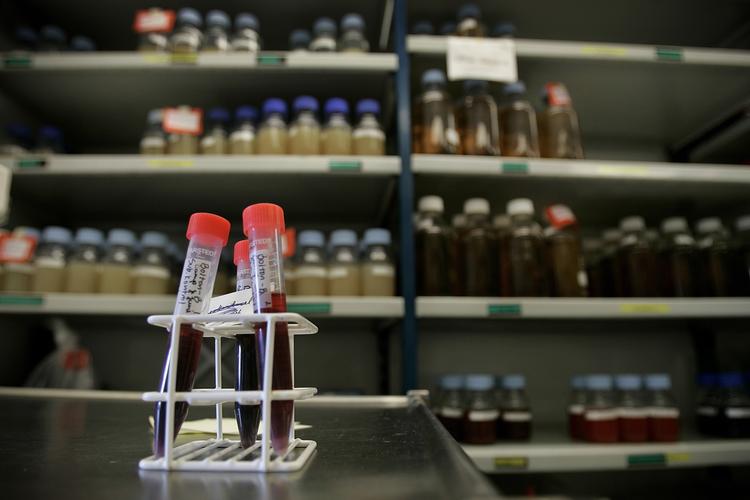 Fødevarekontrollens prøver har vist, at bla. rå medisterpølse solgt på Sjælland står bag mange tilfælde af salmonella. Arkivfoto 