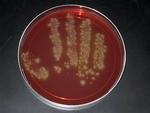 Bakterien Clostridium difficile har lagt sin klamme hånd på adskillige danske hospitaler. 