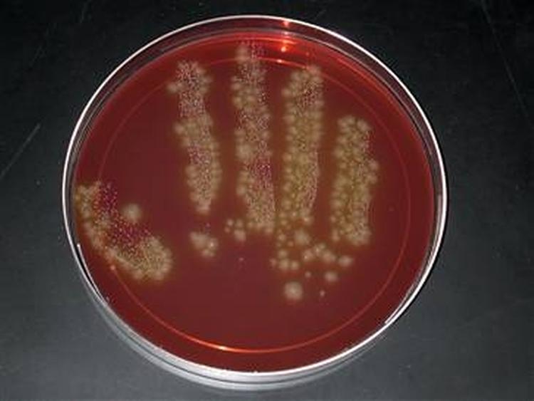 Bakterien Clostridium difficile har lagt sin klamme hånd på adskillige danske hospitaler. 