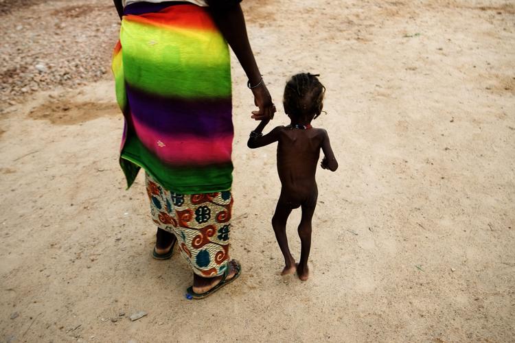 Under-ernæret barn i Niger. FN's menneskerettighed fastslår, at »mødre og børn har krav på særlig omsorg og hjælp«. Arkivfoto 