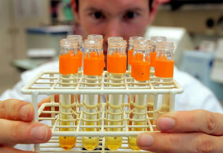 ADD fandt 176 positive dopingprøver i 2008. Arkivfoto. 