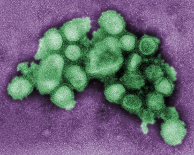 Sådan ser den ud, influenzavirussen A (H1N1), der lige nu holder det meste af verden i ånde. Men den er næppe så farlig som sine forgængere, viser ny forskning. 