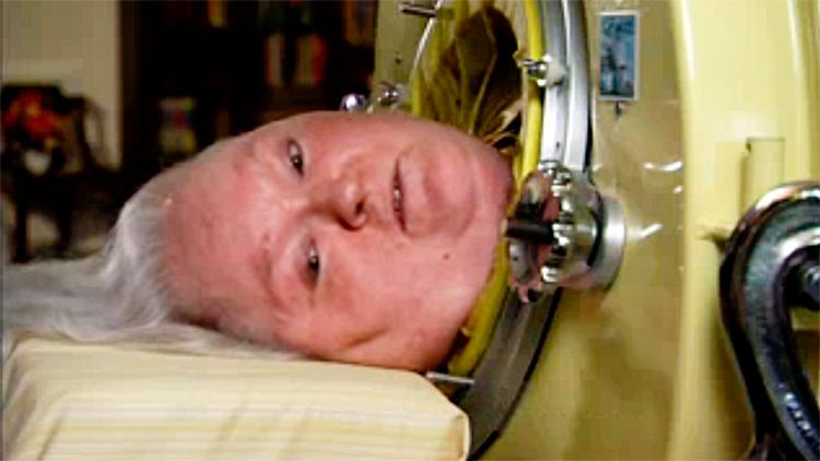 Martha Ann Mason levede mere end 60 år i en jernlunge, men fik et rigt liv med masser af venner og mulighed for intellektuel stimulans. 