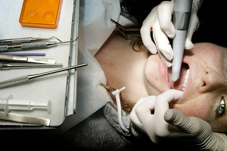 Alle Folketingets partier uden om regeringen er parat til at overveje et større tilskud til tandlægeregningen. Arkivfoto. 