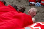 Albino fra Afrika fotograferet efter sejlsads til Tenerifa som asylansøger. Arkivfoto. 