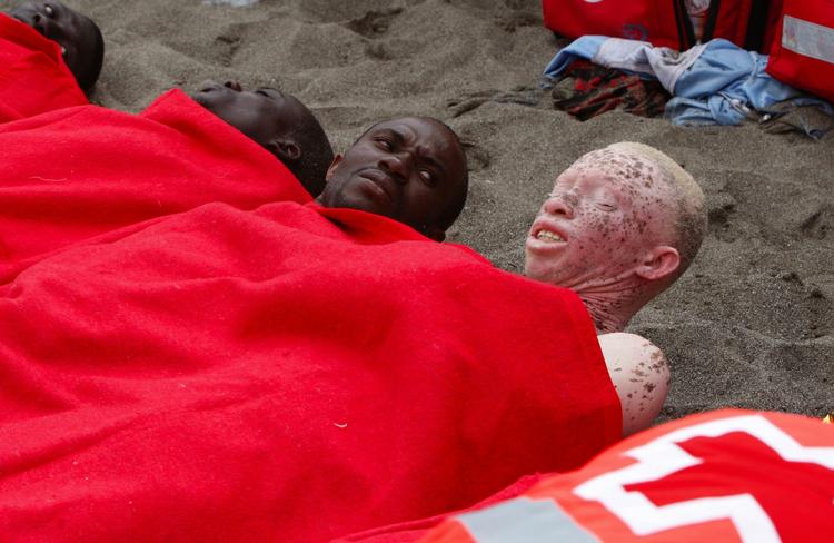 Albino fra Afrika fotograferet efter sejlsads til Tenerifa som asylansøger. Arkivfoto. 