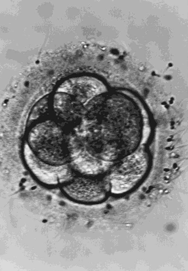 Et befrugtet, ottecellet æg, et såkaldt embryon - forstadiet til et egentligt foster og begyndelsen til et menneske. 