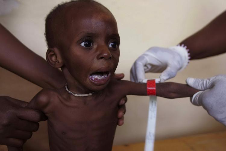 Et underernæret barn bliver målt i en lille landsby i Niger. Verdens rigeste lande vil bruge 80 milliarder kroner på at 