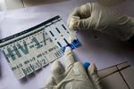 Amerikanske forskere har taget et nyt skridt i retningen mod en hiv-behandling 