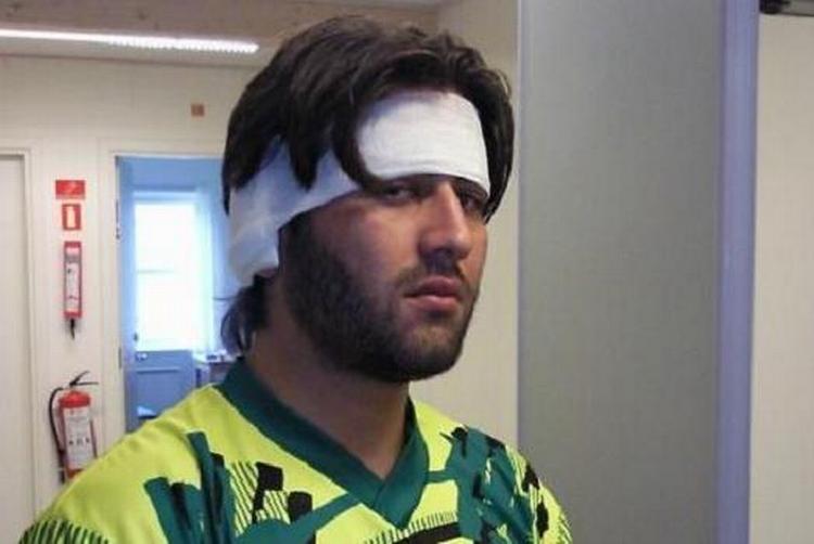 Dette billede af Halo Kheder Karim med hovedbandage blev taget kort efter politiaktionen i Brorsons Kirke. 