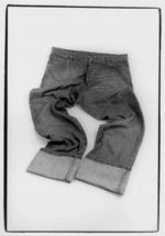 Jeans, shoes and furniture impregnated with Dimethylfumarate can give allergic reactions. 