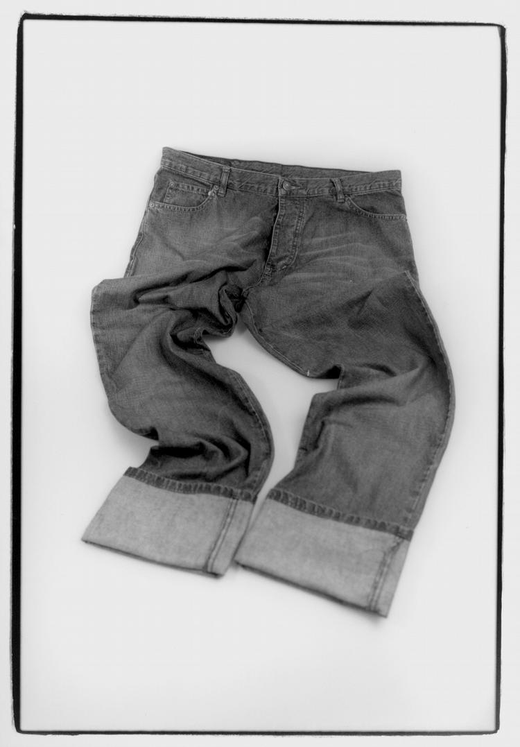 Jeans, shoes and furniture impregnated with Dimethylfumarate can give allergic reactions. 