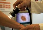 En dansk patient undersøges for hudkræft i et modermærke. Apparaturet er et såkaldt videodermaskop. (arkivfoto) 