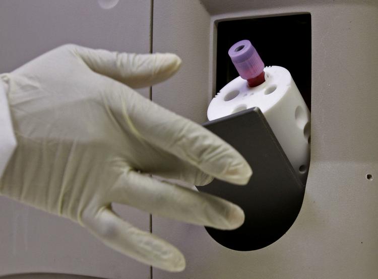 Mange forsøger at udvikle en aids-vaccine. Et af de seneste forsøg blev lanceret i Sydafrika i juli i år. Billedet er fra et laboratorie i Cape Town. (arkivfoto) 