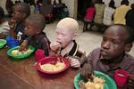 Et albino-barn ses her sammen med sine klassekammerater i Tanzanias hovedstad Dar Es Salaam. Diskriminationen mod albinoer er et voldsomt problem her - som i andre dele af Afrika. 