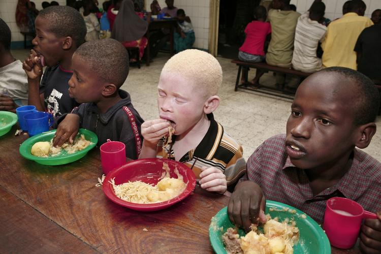 Et albino-barn ses her sammen med sine klassekammerater i Tanzanias hovedstad Dar Es Salaam. Diskriminationen mod albinoer er et voldsomt problem her - som i andre dele af Afrika. 