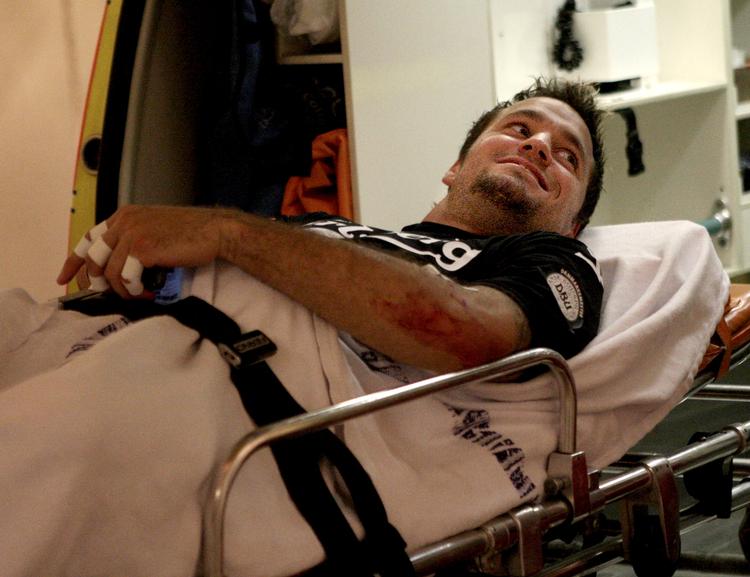 Av min arm. Minutterne efter Jesper Christiansen smadrede sin albue var næppe særlige sjove, selv om FCK-keeperen var i stand til at smile. Nu er han klar igen og bejler til VM-truppen. Arkivfoto. 