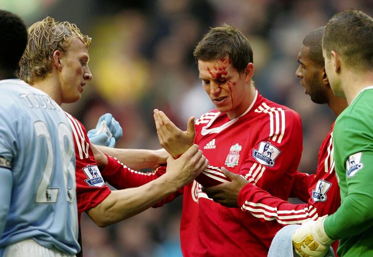 Jernmand. Agger er klar til at spille i morgen. 