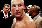 Såret. Flængerne i Mikkel Kesslers ansigt kan ifølge træner Ricard Olsen godt nå at hele inden 6. marts og opgøret mod Carl Froch. 