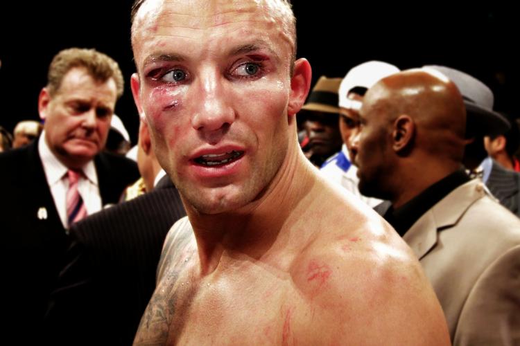 Såret. Flængerne i Mikkel Kesslers ansigt kan ifølge træner Ricard Olsen godt nå at hele inden 6. marts og opgøret mod Carl Froch. 