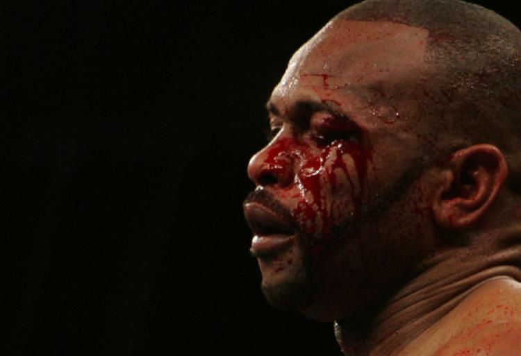 Nedtur. Roy Jones Jr. er før gået blødende fra ringen. Her mod Joe Calzaghe for et år siden. Arkivfoto. 