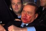 Overfaldet. Silvio Berlusconi umiddelbart efter overfaldet. Billederne stammer fra den italienske tv-station RAI. 